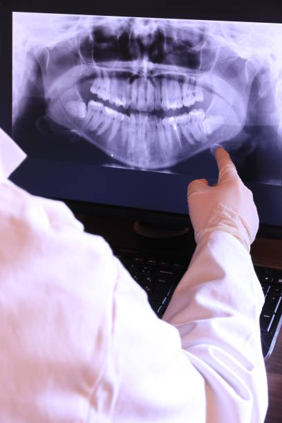 Best Emergency Tooth Extraction in Middleburg, PA